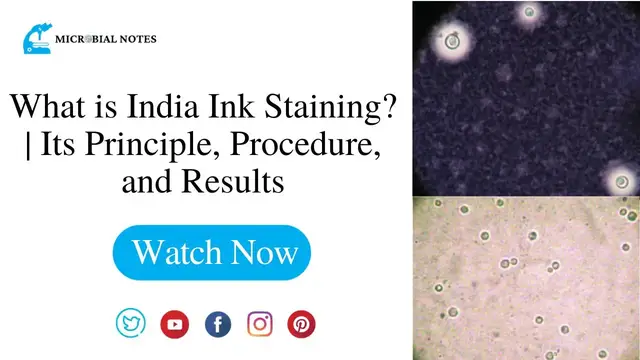 'Video thumbnail for What is India Ink Staining? | Its Principle, Procedure, and Results'