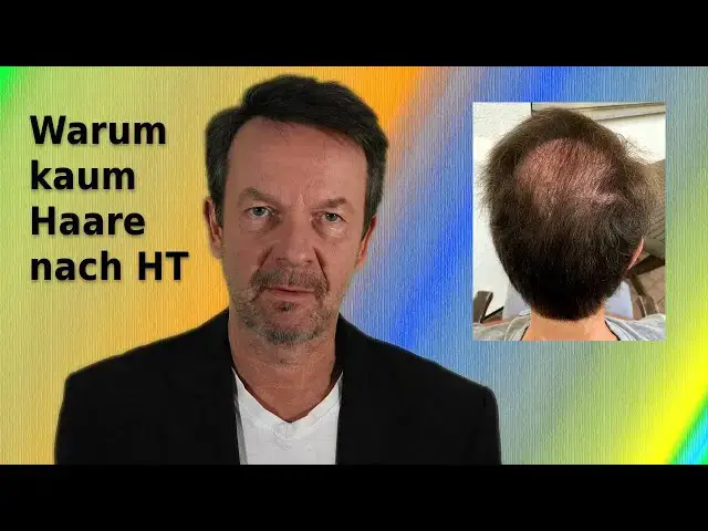 'Video thumbnail for Kaum Haare nach Haartransplantation im Tonsurbereich'